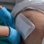 Prevencia šetrí milióny, Slovensko má tisíce pacientov s preležaninami