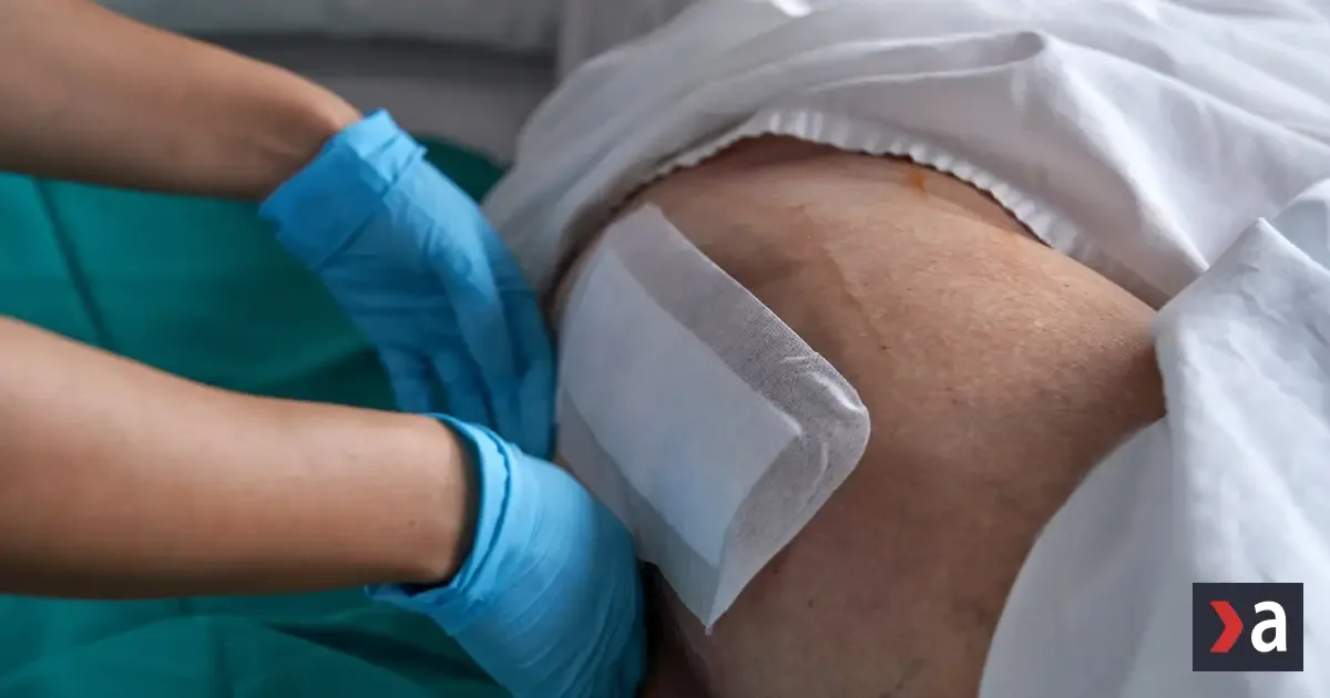Prevencia šetrí milióny, Slovensko má tisíce pacientov s preležaninami 2 Prevencia šetrí milióny, Slovensko má tisíce pacientov s preležaninami